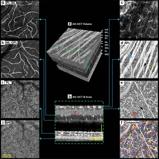 Detailed 3D imaging of retinal cellular structures using a multimodal AO-OCT system utilizing a Wasatch Photonics Cobra-S 800-nm spectrometer.